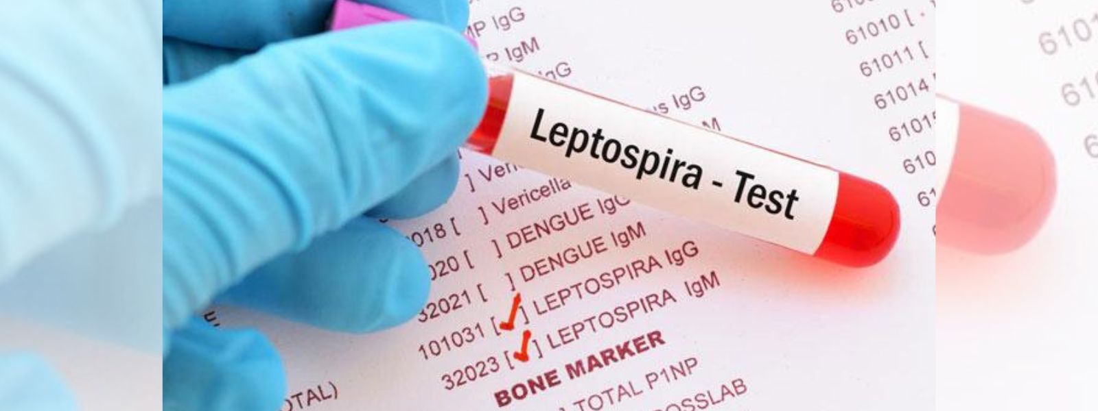 Two Leptospirosis Deaths Reported in Sri Lanka